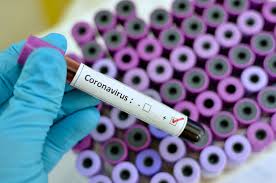 ¿Es justificable el temor y pánico al Coronavirus?